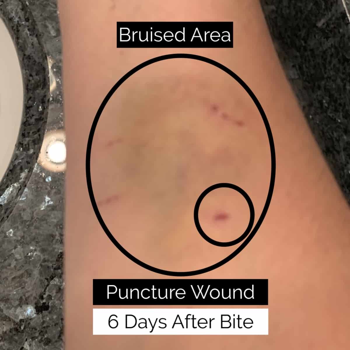 wound day 6